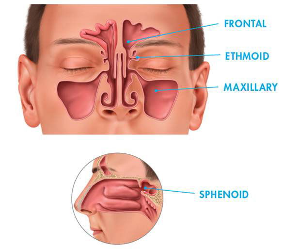 Image showing placement of the frontal, ethomid, maxillary and sphenoid.