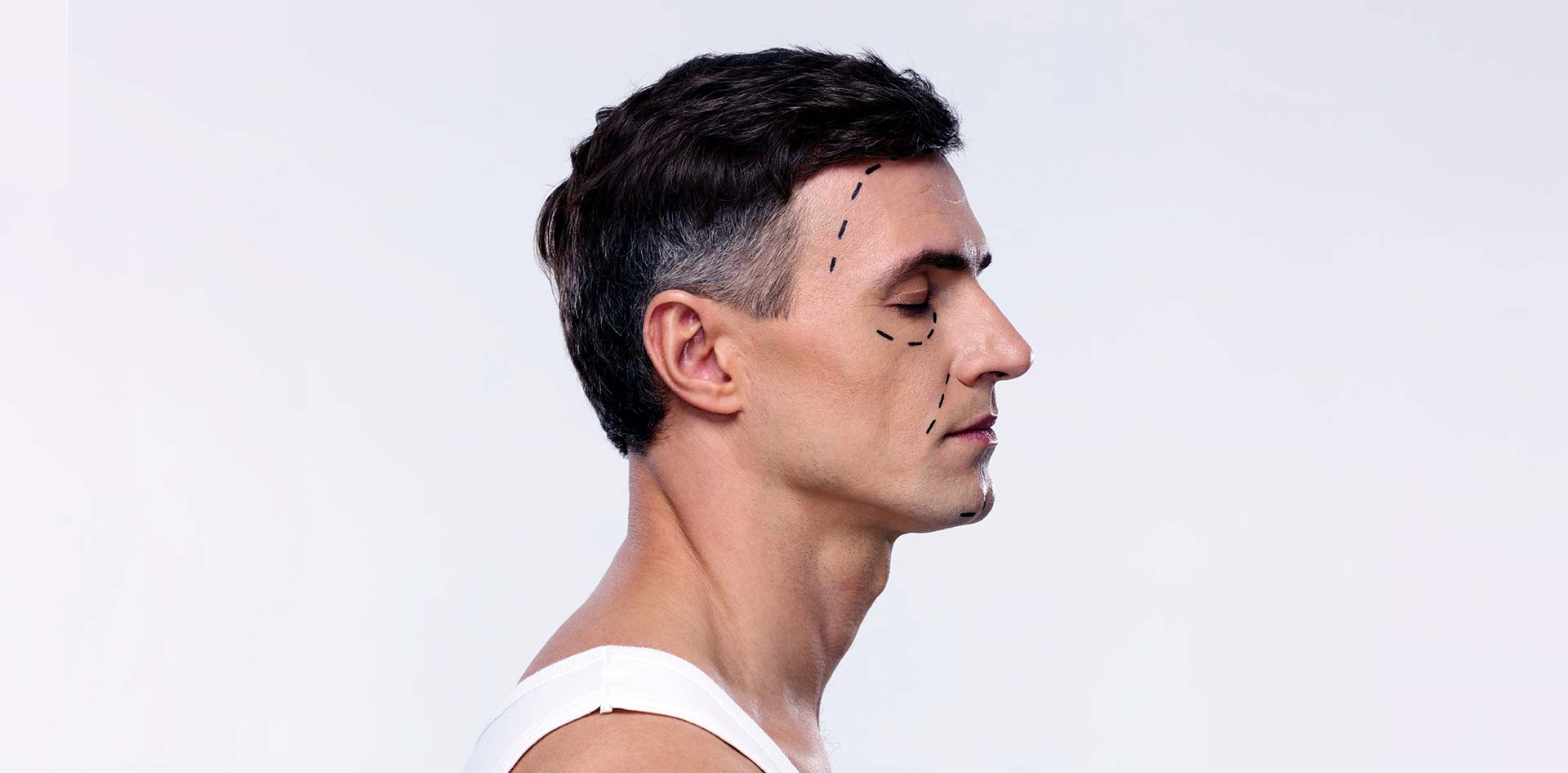 Male Cheek, Chin, & Jaw Augmentation