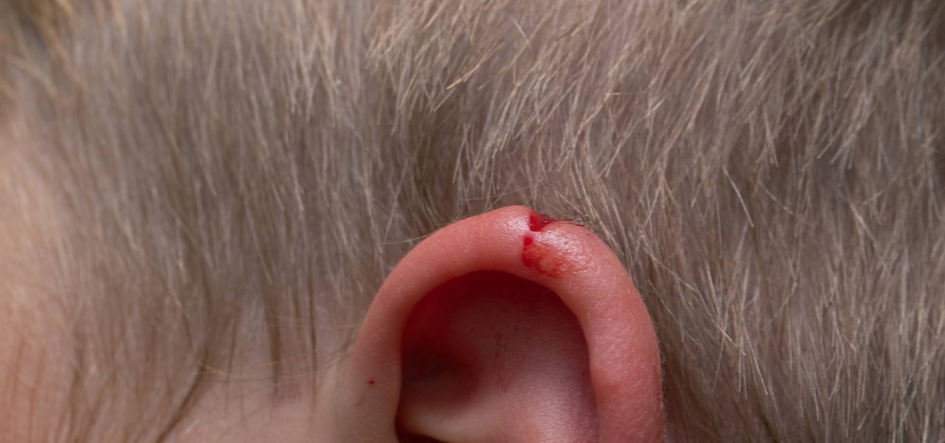 Ear Skin Laceration